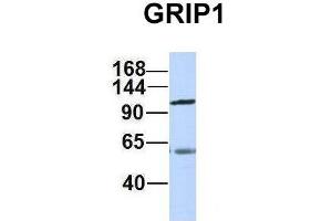Host:  Rabbit  Target Name:  GRIP1  Sample Type:  Human Adult Placenta  Antibody Dilution:  1. (GRIP1 抗体  (C-Term))