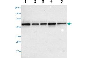 Western blot analysis of Lane 1: RT-4, Lane 2: EFO-21, Lane 3: A-431, Lane 4: Liver, Lane 5: Tonsil with TOM1 polyclonal antibody . (TOM1 抗体)