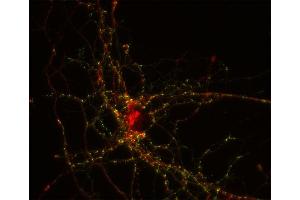 Indirect immunostaining of PFA fixed rat hippocampus neurons with anti-Nedd 4-2 (dilution 1 : 100; red) and mouse anti-synapsin 1 (cat. (NEDD4-2 抗体)