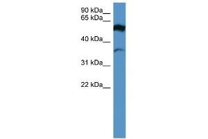 WB Suggested Anti-FSCN2 Antibody Titration: 0. (Fascin 2 抗体  (Middle Region))