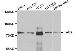 Western blot analysis of extracts of various cell lines, using TAB2 antibody. (TAB2 抗体)