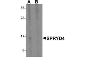 Western blot analysis of SPRYD4 in mouse kidney tissue lysate with SPRYD4 antibody at 1 μg/ml in (A) the absence and (B) the presence of blocking peptide. (SPRYD4 抗体  (Center))