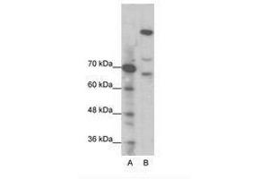 Image no. 1 for anti-Zinc Finger Protein GLI1 (GLI1) (N-Term) antibody (ABIN202973) (GLI1 抗体  (N-Term))