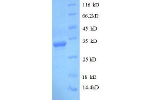 SDS-PAGE (SDS) image for delta-Like 1 Homolog (Drosophila) (DLK1) (AA 24-303) protein (His tag) (ABIN5709405)
