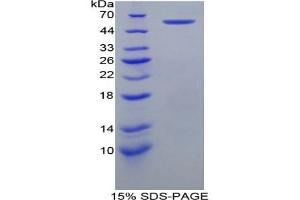 SDS-PAGE analysis of Mouse HSPD1 Protein. (HSPD1 蛋白)