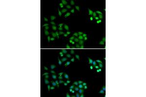 Immunofluorescence analysis of HeLa cells using NSFL1C antibody (ABIN5974024). (NSFL1C 抗体)