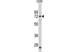 Western Blotting (WB) image for anti-Carnitine O-Acetyltransferase (CRAT) antibody (ABIN3002687) (CRAT 抗体)