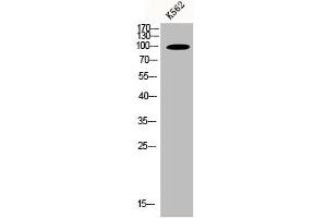 Western Blot analysis of K562 cells using N4BP1 Polyclonal Antibody (N4BP1 抗体  (Internal Region))