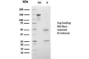 SDS-PAGE Analysis Purified CELA3B Recombinant Mouse Monoclonal Antibody (rCELA3B/1811). (Recombinant Elastase 3B 抗体  (AA 82-238))