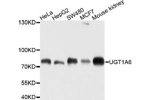 Western blot analysis of extracts of various cells, using UGT1A6 antibody. (UGT1A6 抗体)