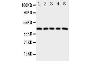 Western Blotting (WB) image for anti-Prostaglandin E Receptor 1 (Subtype EP1), 42kDa (PTGER1) (AA 387-404), (C-Term) antibody (ABIN3043155)