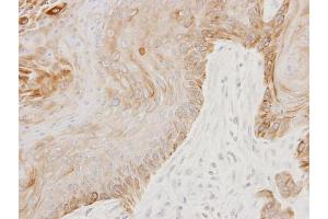Immunohistochemistry (IHC) image for anti-Golgi-Associated, gamma Adaptin Ear Containing, ARF Binding Protein 3 (GGA3) (C-Term) antibody (ABIN2856386)