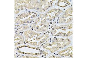Immunohistochemistry of paraffin-embedded human kidney using SP110 Antibody (ABIN6290941) at dilution of 1:100 (40x lens). (SP110 抗体)