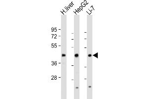 All lanes : Anti-CREB3L3 Antibody (Center) at 1:1000-1:2000 dilution Lane 1: human liver lysate Lane 2: HepG2 whole cell lysate Lane 3: Li-7 whole cell lysate Lysates/proteins at 20 μg per lane. (CREB3L3 抗体  (AA 244-274))