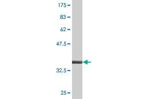 Western Blot detection against Immunogen (37.