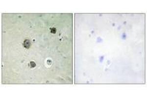 Immunohistochemistry analysis of paraffin-embedded human brain tissue using CDK5 (Ab-15) antibody. (CDK5 抗体  (Tyr15))