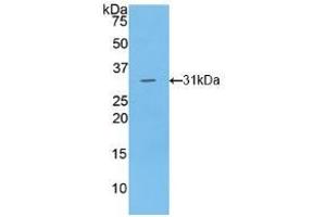 Detection of Recombinant LIPG, Human using Polyclonal Antibody to Lipase, Endothelial (LIPG) (LIPG 抗体  (AA 175-412))