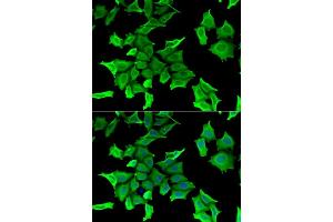 Immunofluorescence (IF) image for anti-serine Peptidase Inhibitor, Kunitz Type, 2 (SPINT2) (AA 28-197) antibody (ABIN6148361)