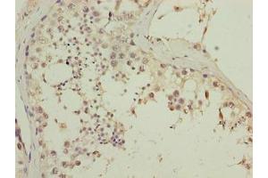 Immunohistochemistry of paraffin-embedded human testis tissue using ABIN7147501 at dilution of 1:100 (CGGBP1 抗体  (AA 1-167))