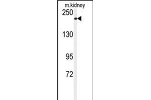 Western blot analysis of anti-CHAK1 Antibody (C-term) (ABIN392614 and ABIN2837991) in mouse kidney tissue lysates (35 μg/lane). (TRPM7 抗体  (C-Term))