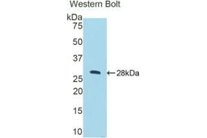 Western blot analysis of the recombinant protein. (CTSC 抗体  (AA 231-462))