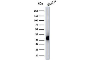 Western Blot Analysis of Human Spleen cell lysate using HLA-Pan Mouse Monoclonal Antibody (CR3/43). (MHC Class II HLA-DP/DQ/DR 抗体)