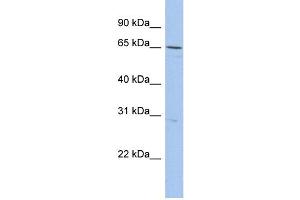 WB Suggested Anti-DQX1 Antibody Titration:  0.