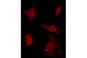 Immunofluorescence (fixed cells) (IF/ICC) image for anti-Zinc Finger Protein 174 (ZNF174) (Internal Region) antibody (ABIN6266111)