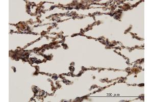 Immunoperoxidase of monoclonal antibody to HBB on formalin-fixed paraffin-embedded human lung. (Hemoglobin Subunit beta 抗体  (AA 38-147))