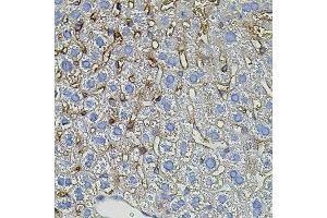 Immunohistochemistry of paraffin-embedded mouse liver using TGFA antibody. (Pro-TGF-alpha 抗体)