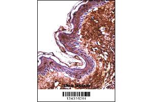 PPT2 Antibody immunohistochemistry analysis in formalin fixed and paraffin embedded human skin tissue followed by peroxidase conjugation of the secondary antibody and DAB staining. (PPT2 抗体  (AA 183-212))