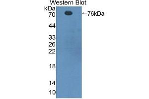 Western blot analysis of recombinant Rat CTTN. (Cortactin 抗体  (AA 1-509))