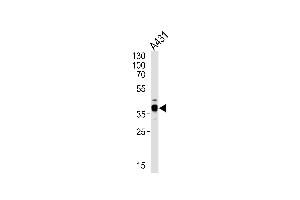 Western blot analysis of lysate from A431 cell line, using ARPC1B Antibody at 1:1000 at each lane. (ARPC1B 抗体  (AA 159-188))