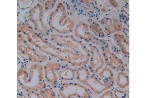 Immunohistochemistry (IHC) image for anti-Vitamin D-Binding Protein (GC) (AA 209-401) antibody (ABIN7442033)