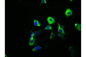 Immunofluorescence staining of MCF-7 cells with ABIN7171161 at 1:166, counter-stained with DAPI. (SYT6 抗体  (AA 104-425))
