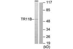 Western Blotting (WB) image for anti-Tumor Necrosis Factor Receptor Superfamily, Member 11b (TNFRSF11B) (AA 10-59) antibody (ABIN2889302) (Osteoprotegerin 抗体  (AA 10-59))
