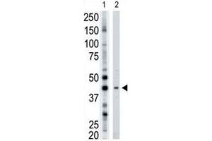 Western Blotting (WB) image for anti-ADP-Ribosyltransferase 3 (ART3) antibody (ABIN3001504) (ART3 抗体)