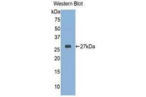 Western Blotting (WB) image for anti-FK506 Binding Protein 3, 25kDa (FKBP3) (AA 2-224) antibody (ABIN1078042) (FKBP3 抗体  (AA 2-224))