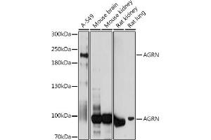 Western blot analysis of extracts of various cell lines, using AGRN antibody (ABIN7265516) at 1:1000 dilution. (AGRN 抗体  (AA 30-350))