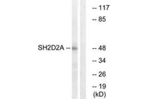 Western blot analysis of extracts from HepG2 cells, using SH2D2A Antibody. (SH2D2A 抗体  (AA 211-260))