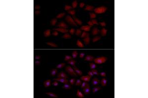Immunofluorescence analysis of A-549 cells using PGP9. (UCHL1 抗体  (AA 1-220))