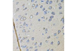 Immunohistochemistry of paraffin-embedded rat brain using CDH16 antibody. (Cadherin-16 抗体  (AA 19-230))