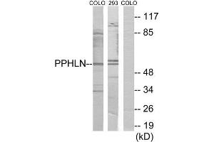 Western Blotting (WB) image for anti-Periphilin 1 (PPHLN1) (Internal Region) antibody (ABIN1849790) (PPHLN1 抗体  (Internal Region))