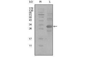 Western Blot showing ALCAM antibody used against truncated Trx-ALCAM recombinant protein (1). (CD166 抗体  (AA 405-524))