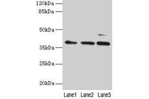 Western blot All lanes: MRPL3 antibody at 6 μg/mL Lane 1: Hela whole cell lysate Lane 2: HepG2 whole cell lysate Lane 3: A549 whole cell lysate Secondary Goat polyclonal to rabbit IgG at 1/10000 dilution Predicted band size: 39 kDa Observed band size: 39 kDa (MRPL3 抗体  (AA 201-348))