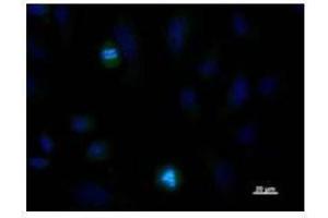 Immunostaining analysis in HeLa cells. (NDC80 抗体)