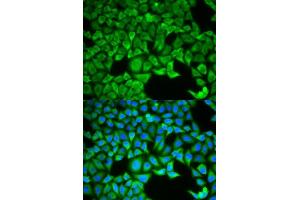 Immunofluorescence analysis of HeLa cells using SLC3A1 antibody. (SLC3A1 抗体  (AA 416-685))