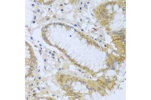 Immunohistochemistry of paraffin-embedded human stomach using  antibody (ABIN6127321, ABIN6136446, ABIN6136448 and ABIN6216005) at dilution of 1:100 (40x lens). (ACP1 抗体  (AA 1-158))