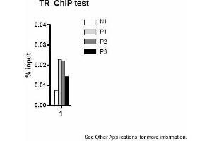 Application: ChIPSample type: mouse liver tissueChromatin Used: 100ug tissueAntibody Used: 10ug  Image Submitted by: Joanna DiSpirito, University of Pennsylvania (THRB 抗体  (N-Term))