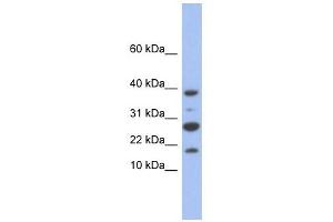 NDUFC1 antibody used at 1 ug/ml to detect target protein. (NDUFC1 抗体)